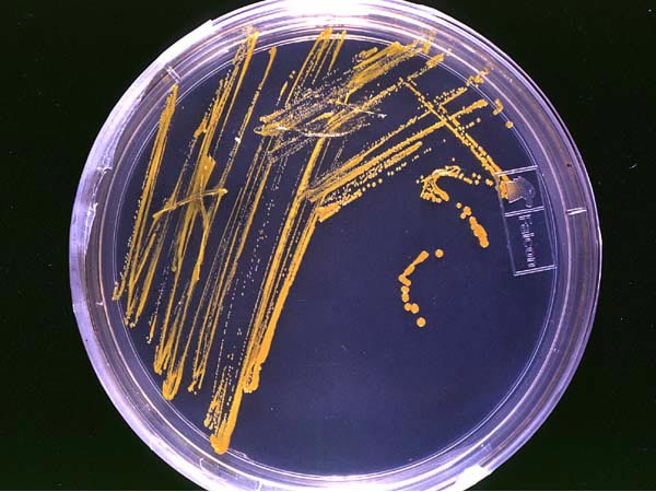 Colònies bacterianes en placa d'agar. Es pot veure com es formen i creixen els microorganismes.