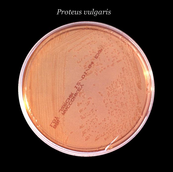 Placa de Petri amb agar MacConkey sòlid i un inòcul en estria de Proteus vulgaris. Aquesta imatge ens ajuda a veure com creixen els bacteris en un laboratori.